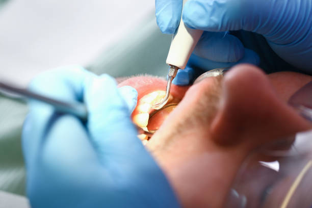 Best Mobile Emergency Dentist in Jonesboro, GA