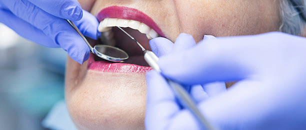 Best Emergency Dentist for Lost Fillings or Crowns in Jonesboro, GA